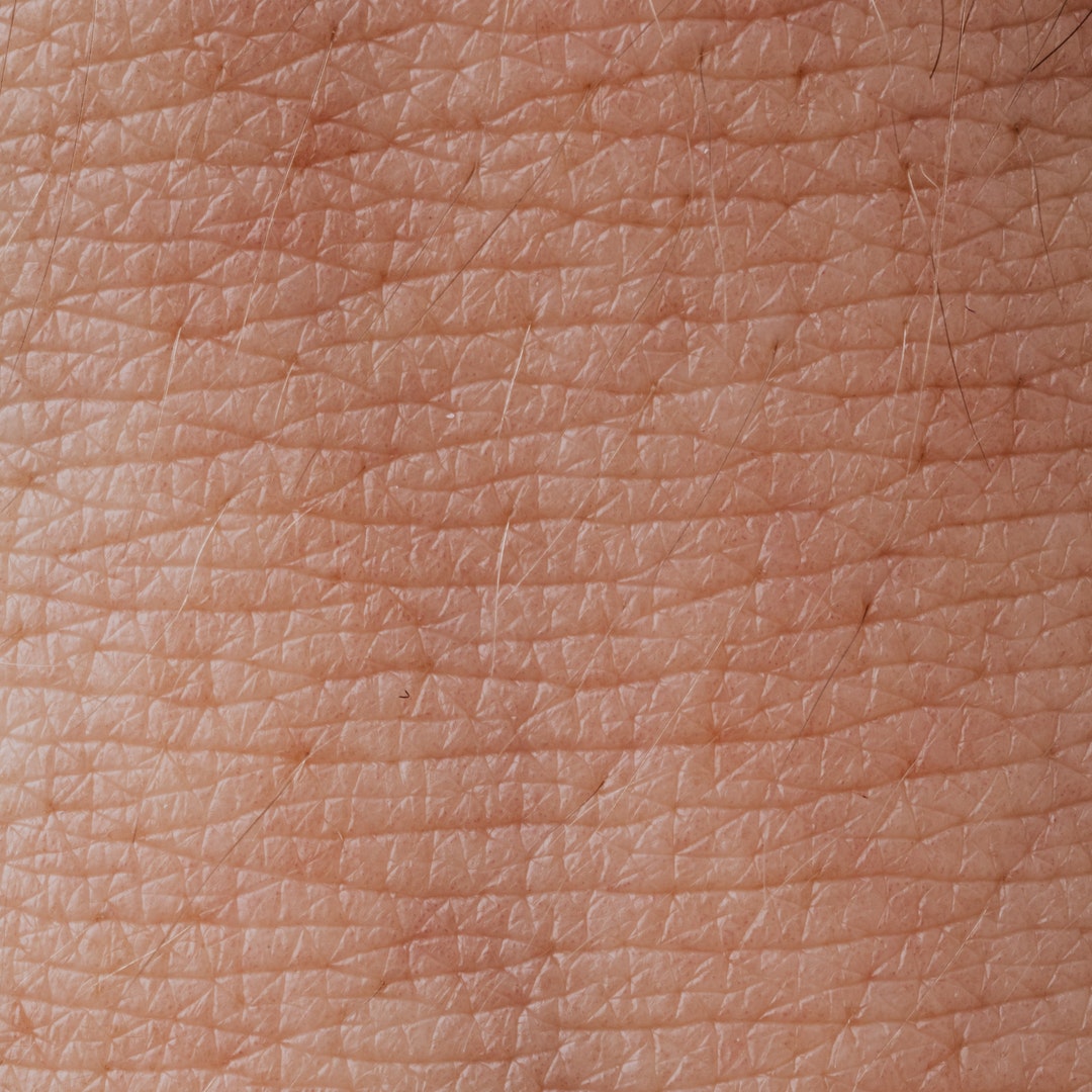 The Common Types Of Dermatitis